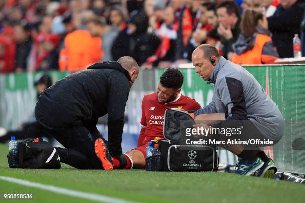 Alex Oxlade-Chamberlain of Liverpool is treated for an injury during the UEFA Champions League Semi Final First Leg match between Liverpool and A.S....