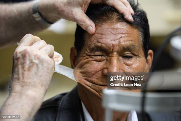 Corneal edema aphakia patient Jose, aged 87, has his eye patch removed before undergoing post-op tests after the previous days surgery at the IRO on...