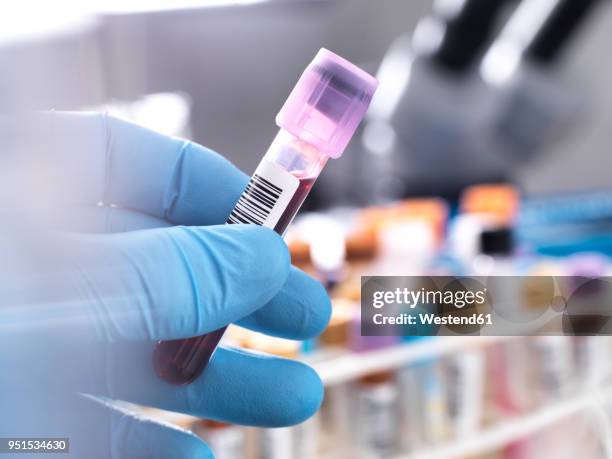 medical technician preparing a human blood sample for clinical testing - bluttest stock-fotos und bilder