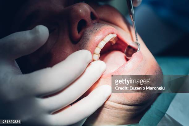 dentist carrying out dental procedure on male patient, close-up - dentist phobia stock-fotos und bilder