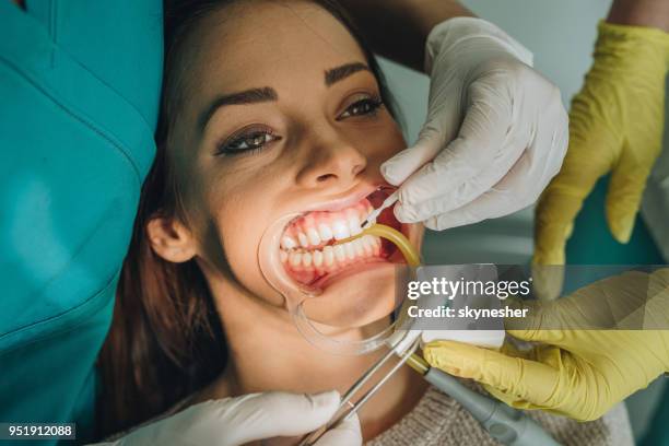 dental procedure at dentist's office! - plaque remover stock pictures, royalty-free photos & images