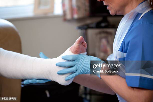 zorg voor haar been letsel - bandage stockfoto's en -beelden