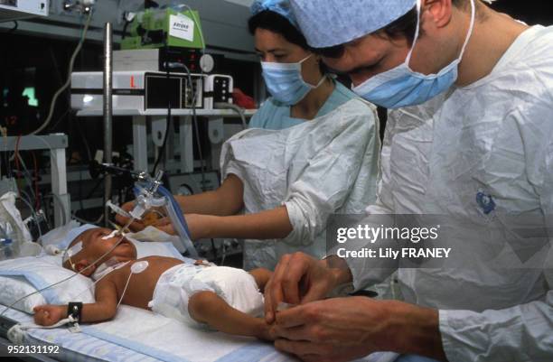 Pédiatres soignant un nouveau-né à l'hôpital du Kremlin-Bicêtre, en janvier 1990, dans le Val-de-Marne, France.