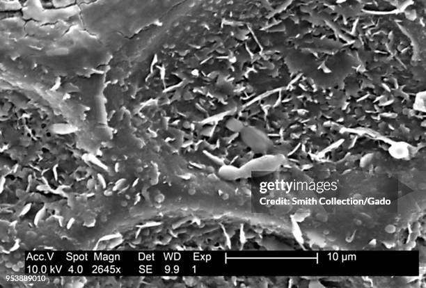 Textured surface details found on a honeydew melon , revealed in the 2645x magnified electron micrograph film, 2004. Image courtesy Centers for...