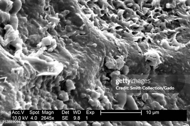 Textured surface details found on a honeydew melon , revealed in the 2645x magnified electron micrograph film, 2004. Image courtesy Centers for...