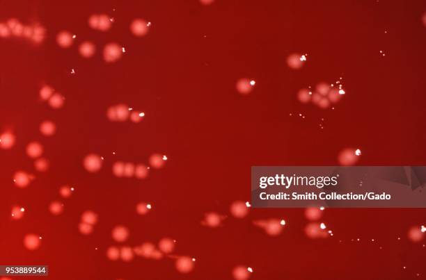 Colonial morphology of Gram-negative, facultatively anaerobic Citrobacter freundii bacteria cultivated on a blood agar plate , 1976. Image courtesy...