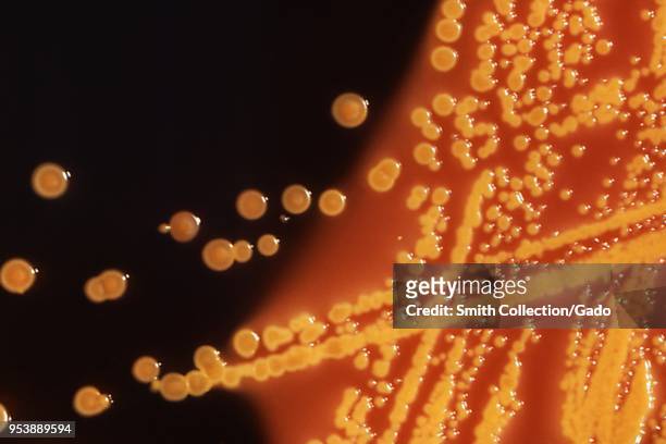 Colonies of Escherichia coli bacteria grown on a Hektoen enteric agar plate, 1976. Image courtesy Centers for Disease Control .