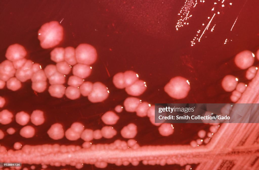 Proteus Mirabilis Bacteria