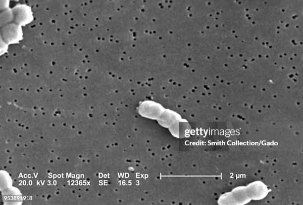 Gram-negative, non-motile Acinetobacter baumannii bacteria revealed in the 12365x magnified scanning electron microscopic image, 2004. Image courtesy...