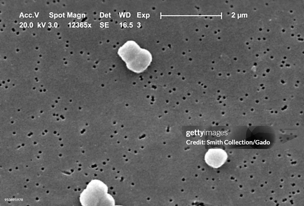 Acinetobacter Baumannii