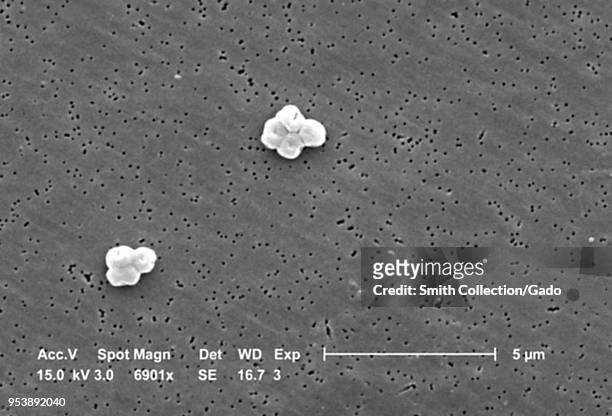 Gram-negative, non-motile Acinetobacter baumannii bacteria revealed in the 6901x magnified scanning electron microscopic image, 2004. Image courtesy...