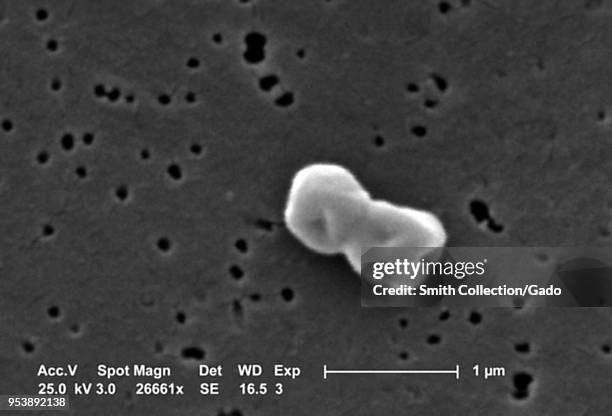 Gram-negative, non-motile Acinetobacter baumannii bacteria revealed in the 26661x magnified scanning electron microscopic image, 2004. Image courtesy...