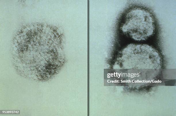 Three Sin Nombre virus virions, members of the genus Hantavirus, depicted in the negatively stained transmission electron microscopic image, 1993....