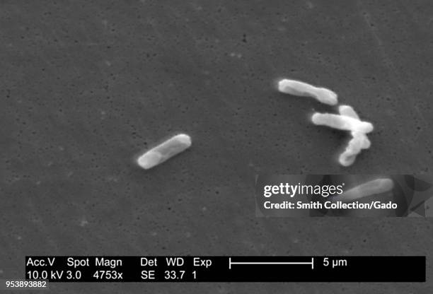 Gram-positive Clostridium difficile bacteria revealed in the stool sample micrograph film, 2004. Image courtesy Centers for Disease Control / Lois S....