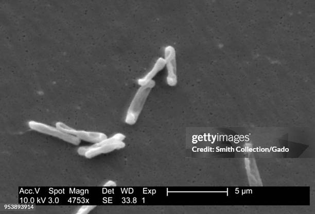 Gram-positive Clostridium difficile bacteria revealed in the stool sample micrograph film, 2004. Image courtesy Centers for Disease Control / Lois S....