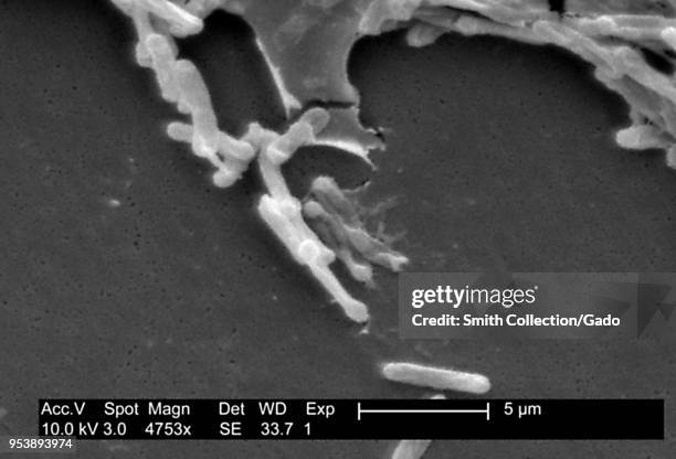 Gram-positive Clostridium difficile bacteria revealed in the stool sample micrograph film, 2004. Image courtesy Centers for Disease Control / Lois S....