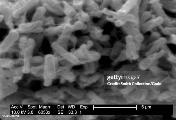 Gram-positive Clostridium difficile bacteria revealed in the stool sample micrograph film, 2004. Image courtesy Centers for Disease Control / Lois S....