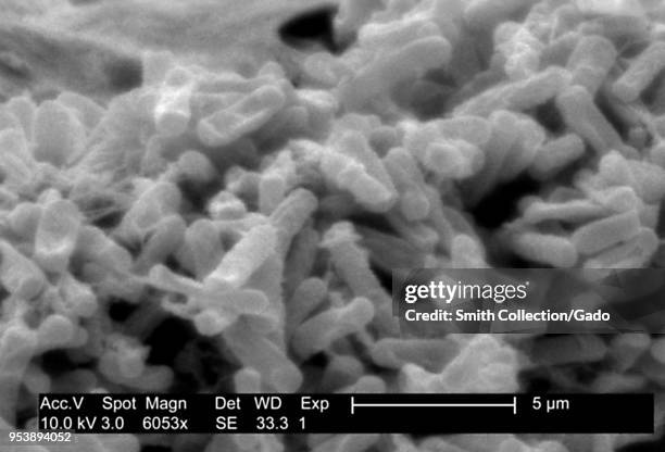 Gram-positive Clostridium difficile bacteria revealed in the stool sample micrograph film, 2004. Image courtesy Centers for Disease Control / Lois S....