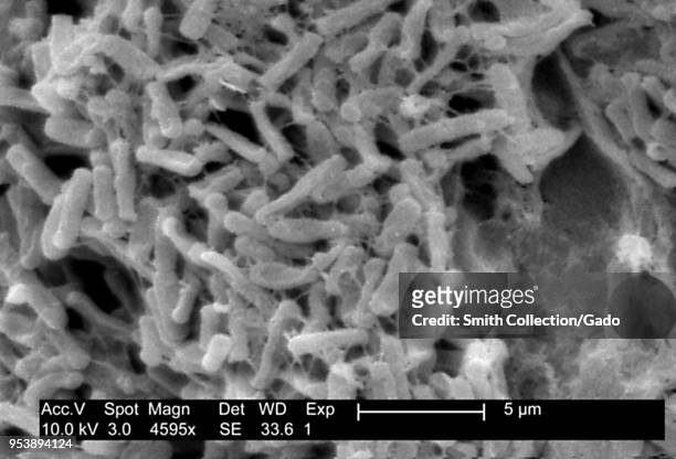 Gram-positive Clostridium difficile bacteria revealed in the stool sample micrograph film, 2004. Image courtesy Centers for Disease Control / Lois S....