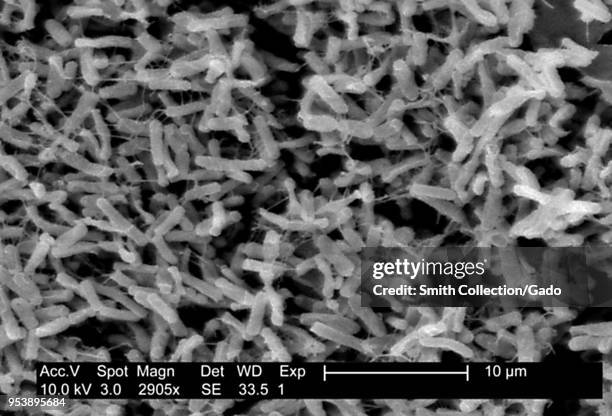 Gram-positive Clostridium difficile bacteria revealed in the stool sample micrograph film, 2004. Image courtesy Centers for Disease Control / Lois S....