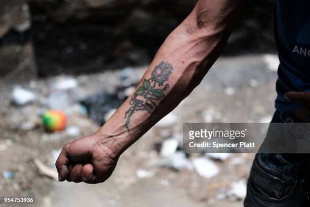 Eliezer, a 38 year old homeless heroin addict, displays his arm in which he injects drugs in the Bronx on May 4, 2018 in New York City. Eliezer often...