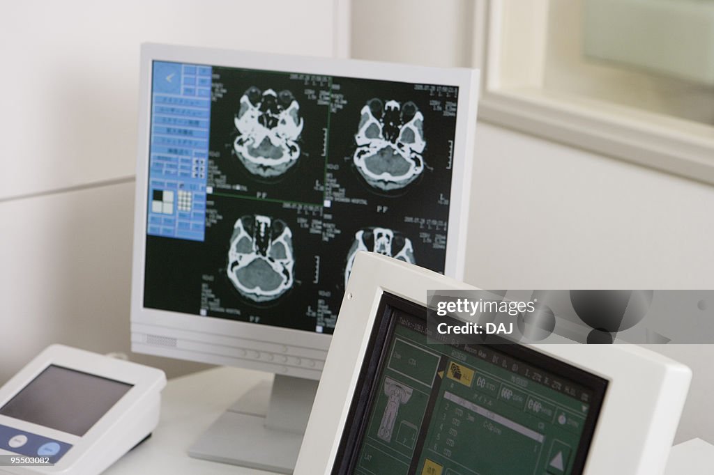 Computerized Tomography System Computerized Tomography High-Res Stock Photo - Getty Images