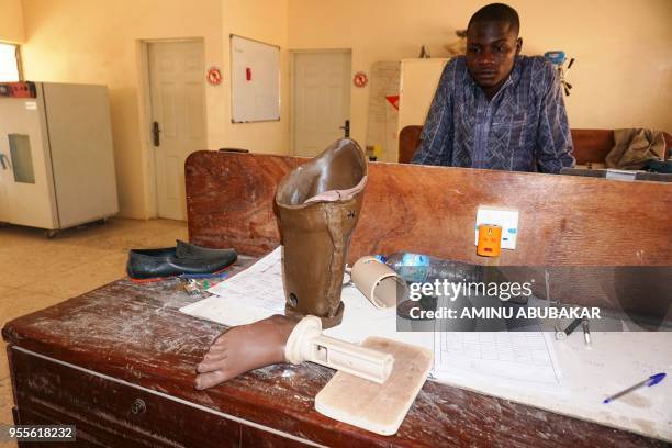 Technician looks at unfinished parts of an artificial leg in the artificial limb fitting workshop operated by the International Committee of the Red...