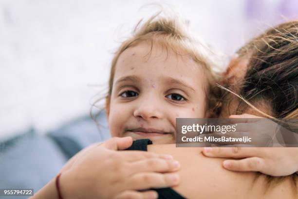 mother taking care of little girl with chicken pox - morbillivirus stock pictures, royalty-free photos & images