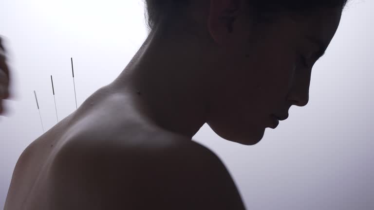 https://media.gettyimages.com/id/956035048/video/young-woman-receiving-acupuncture-on-back.jpg?b=1&s=640x640&k=20&c=f-K4FkN2aD2UI1UJET8DPkaAWC8la3j_yKpEpN3nsYI=
