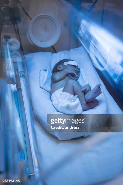 niedlichen kleinen neugeborenen für gelbsucht im inkubator behandelt - premature baby incubator stock-fotos und bilder