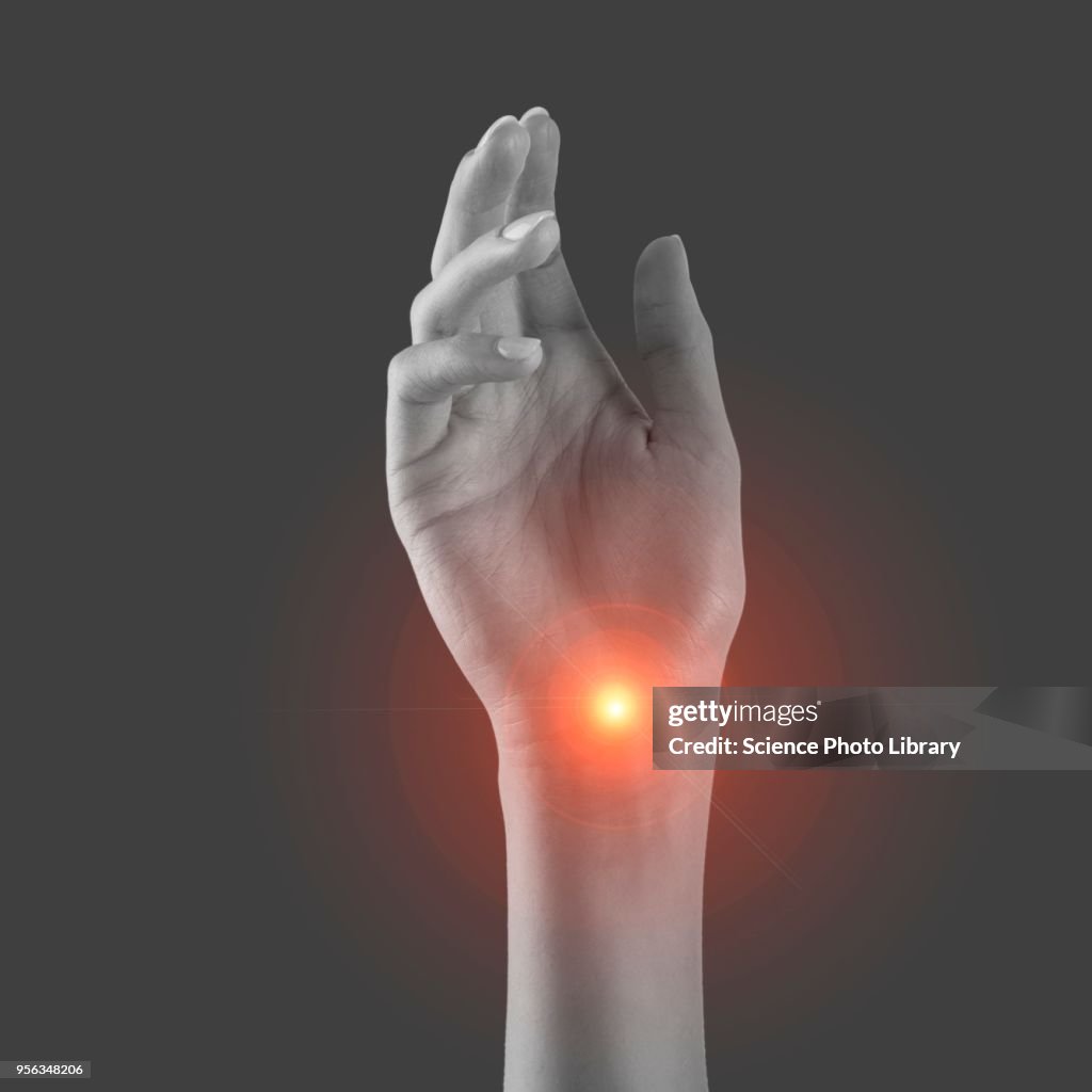 Wrist pain, conceptual image