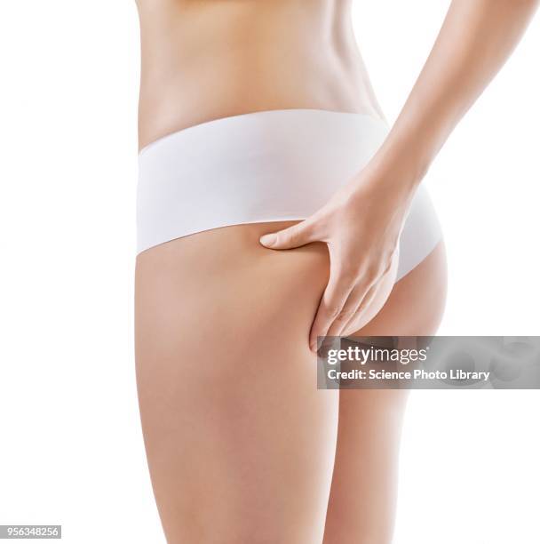 cellulite, conceptual image - pinching stock pictures, royalty-free photos & images