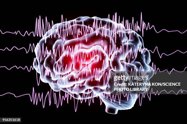 brain and brain waves in epilepsy, illustration - brain activity stock illustrations