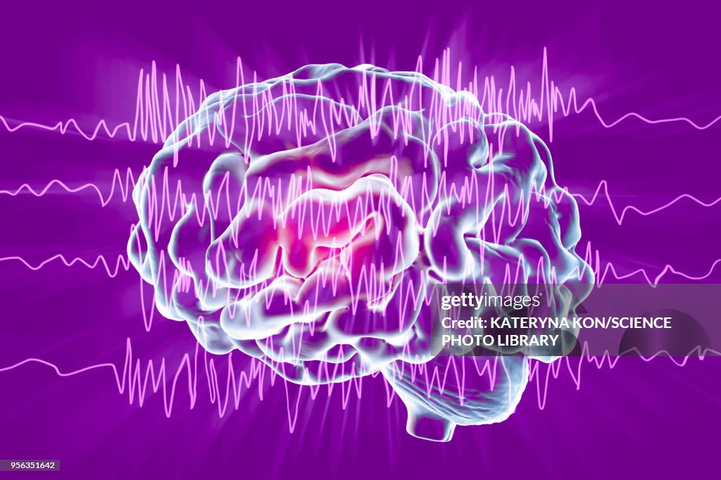 Brain and brain waves in epilepsy, illustration