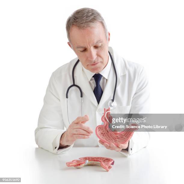 doctor with model of stomach with gastric band - gastric band treatment stock pictures, royalty-free photos & images