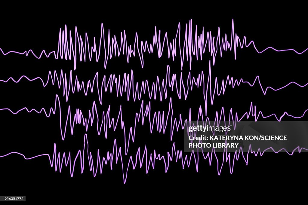 Brain Wave Ripples Epilepsy Brain Waves
