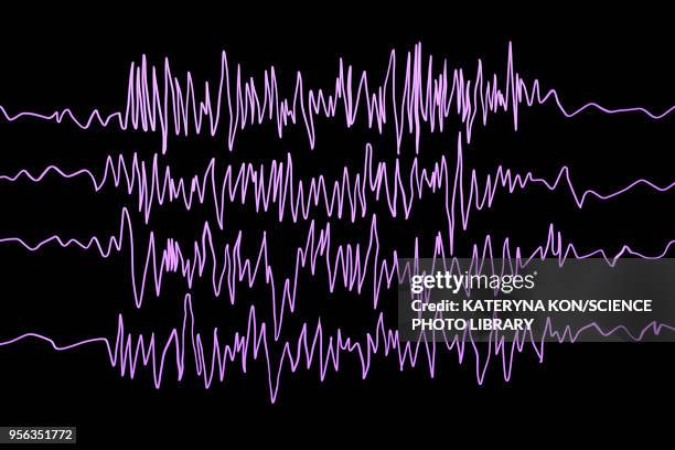 brain waves in epilepsy, illustration - eeg stock illustrations