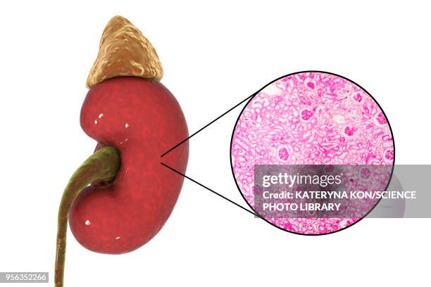 human kidney, illustration and micrograph - 毛細血管点のイラスト素材／クリップアート素材／マンガ素材／アイコン素材