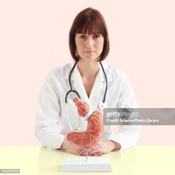 doctor with model of stomach with gastric band - gastric band treatment stock pictures, royalty-free photos & images