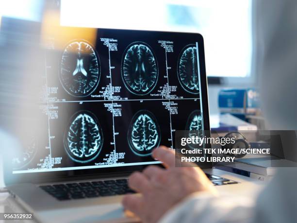 human brain scan - medical scan stockfoto's en -beelden