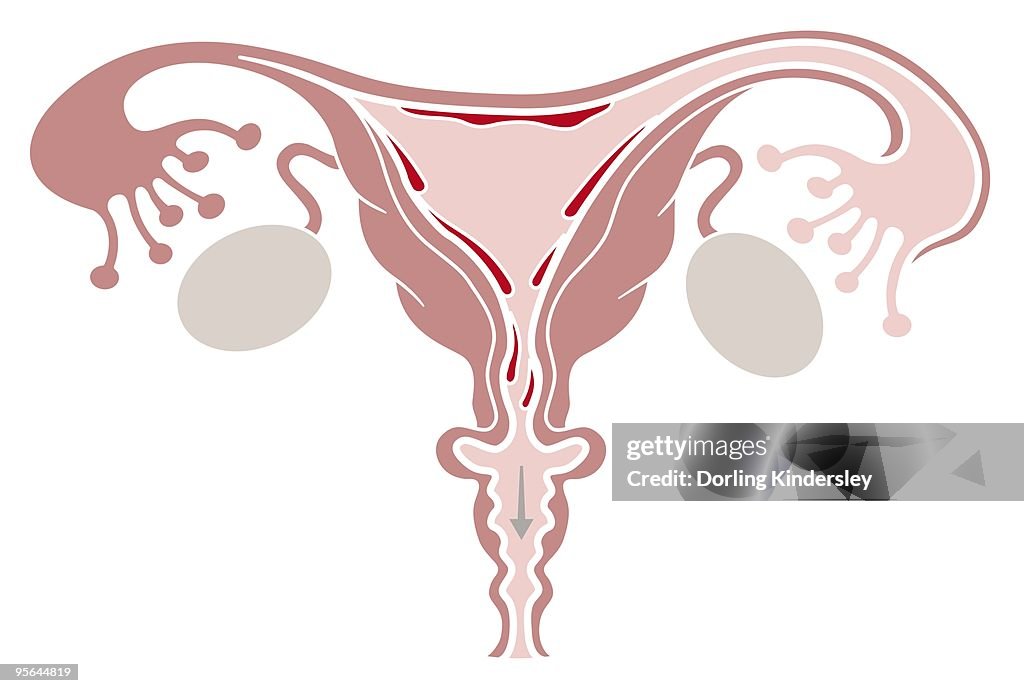 Digital illustration of shedding uterine lining during menstruation