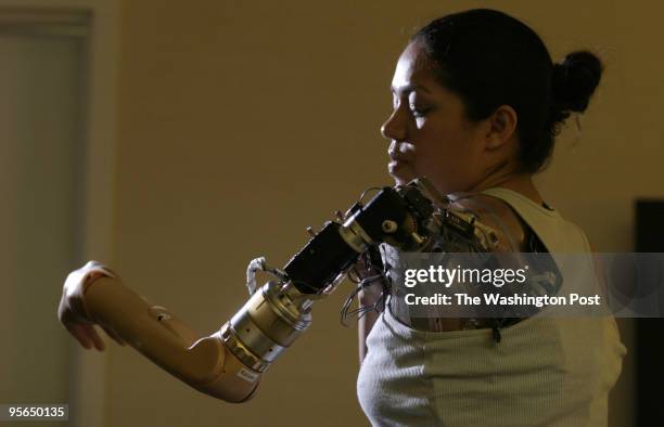 Claudia Mitchell, who lives in Ellicott City, is the first woman to be equipped with a bionic arm. She can think to make it move. She is pictured in...