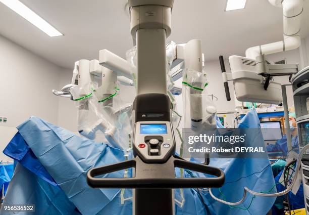 Olivier Raspado, chirurgien digestif spécialisé en chirurgie mini-invasive, coelioscopique et robotique utilise le robot 'Da Vinci S-HD' qui fournit...