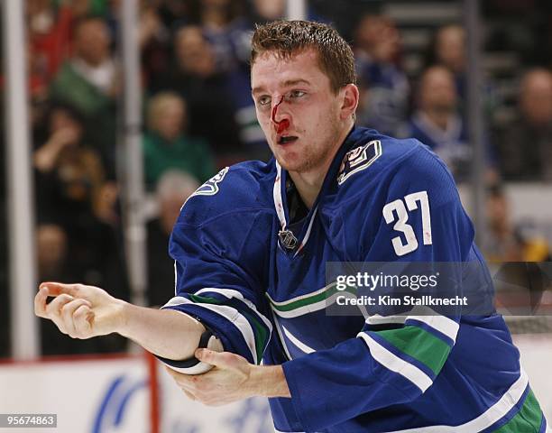 Bloodied Rick Rypien of the Vancouver Canucks skates to the bench after a fight in his game against the Calgary Flames at General Motors Place on...