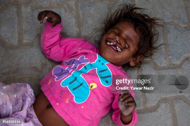 An Indian child beggar Arjun, 3 years old with the disfigured face, begs with his father on a roadside on May 10, 2018 in Srinagar, the summer...