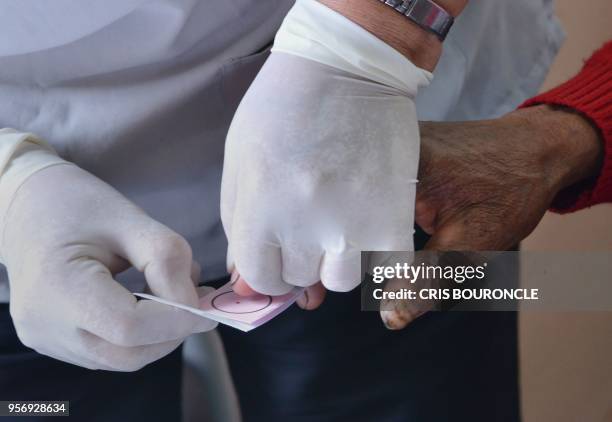 Blood samples are collected among residents of Culluchaca --a small rural community of 700 families at 3,800 meters above sea level in the Andes-- as...