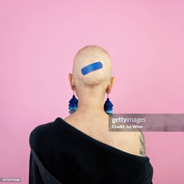 Back of woman's bald head with bandage