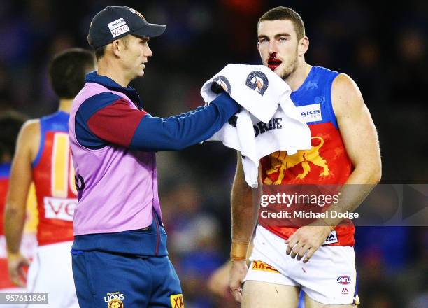 Daniel McStay of the Lions comes off injured during the round eight AFL match between the Western Bulldogs and the Brisbane Lions at Etihad Stadium...