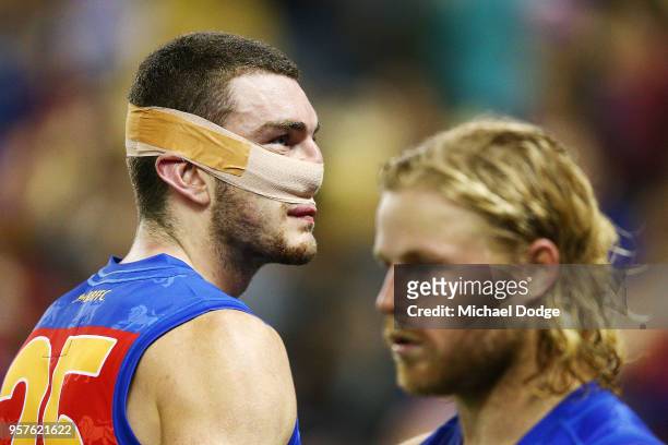 Daniel McStay of the Lions looks dejected after defeat during the round eight AFL match between the Western Bulldogs and the Brisbane Lions at Etihad...