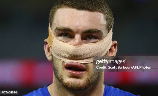 Daniel McStay of the Lions leaves the field injured after losing the round eight AFL match between the Western Bulldogs and the Brisbane Lions at...